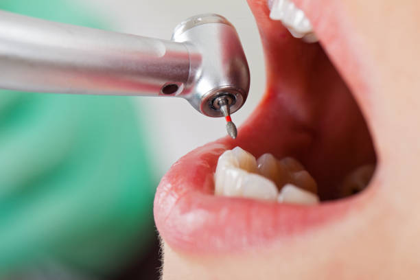 Best Cracked Tooth Emergency Dentist  in South Temple, PA